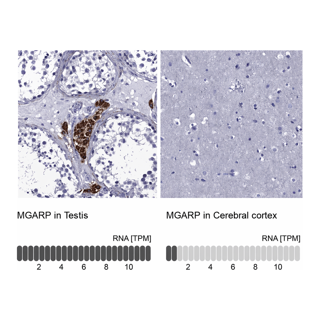 Atlas Antibodies Anti-MGARP Antibody
