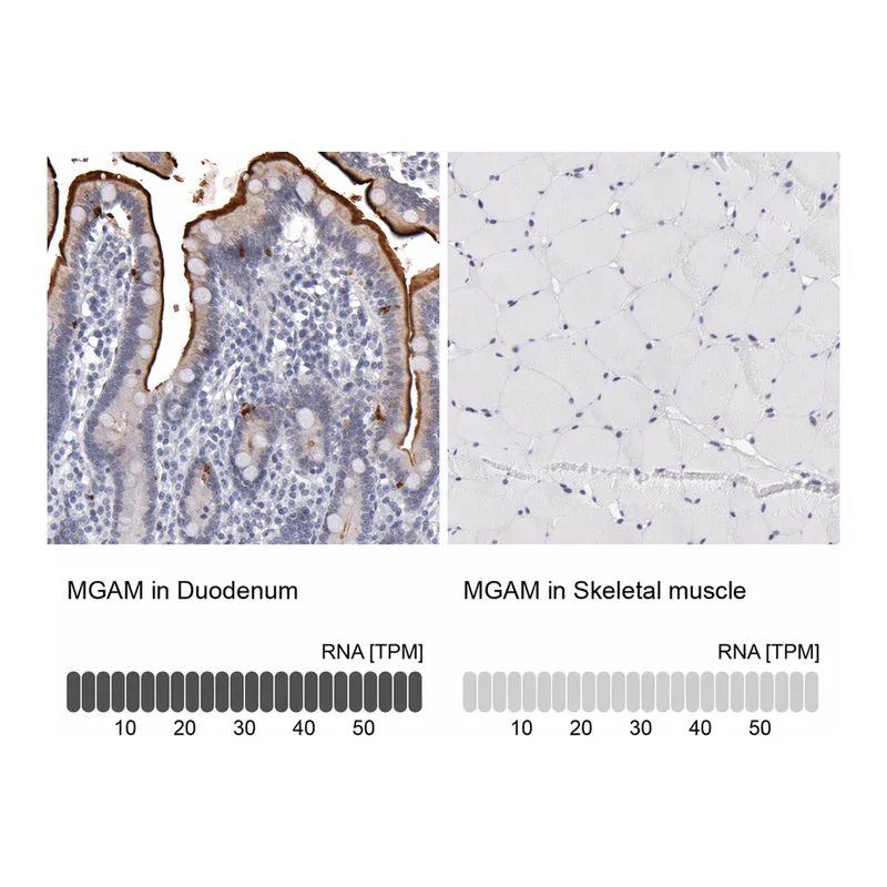 Atlas Antibodies Anti-MGAM Antibody