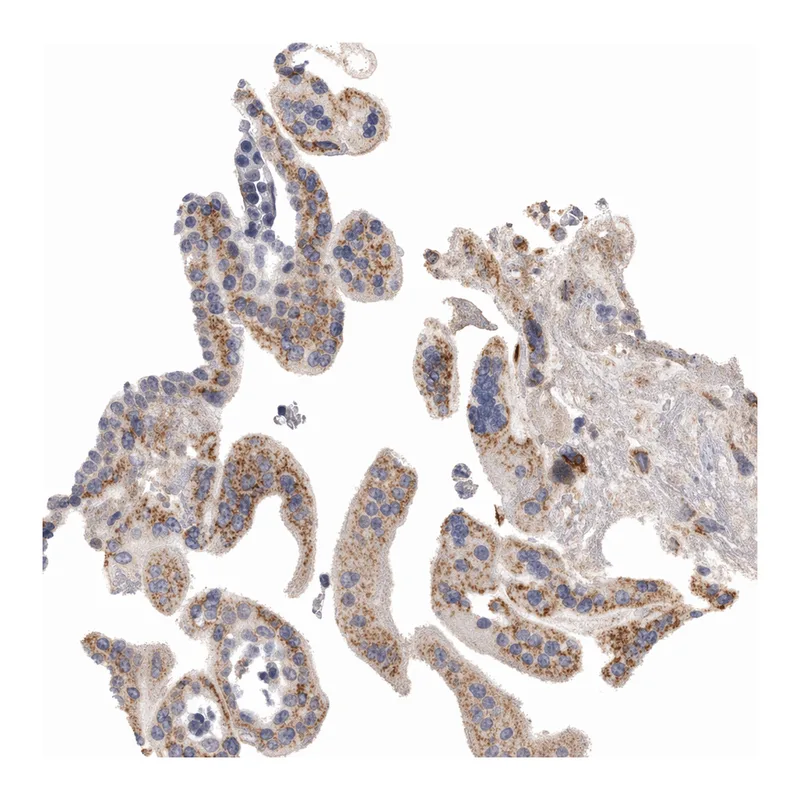 Atlas Antibodies Anti-MGAT1 Antibody