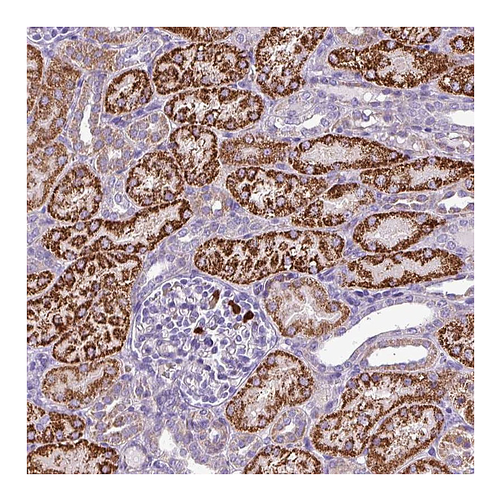 Atlas Antibodies Anti-MGAT4B Antibody