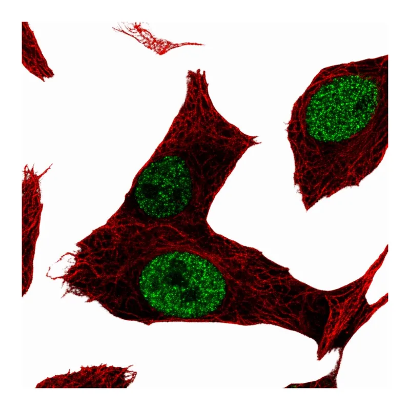 Atlas Antibodies Anti-MGAT5B Antibody