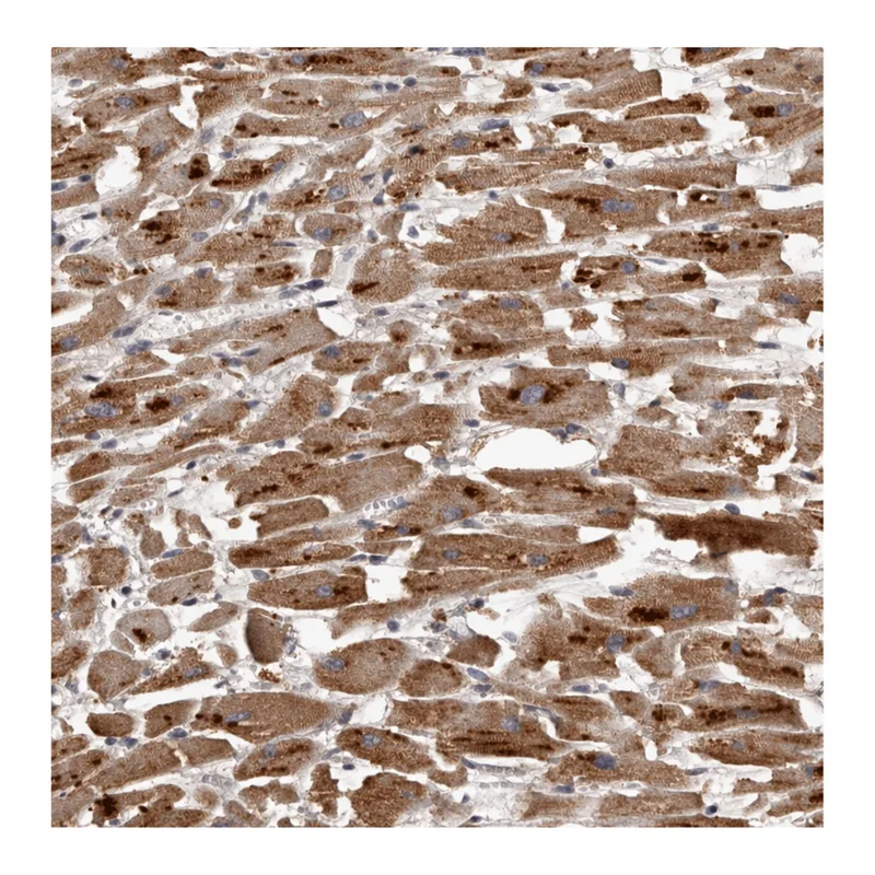 Atlas Antibodies Anti-MGAT5 Antibody