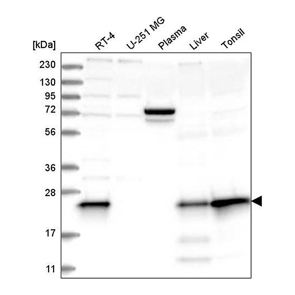 Atlas Antibodies Anti-MGMT Antibody