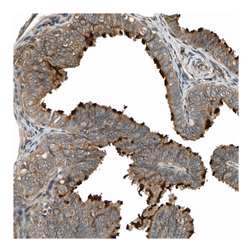 Atlas Antibodies Anti-MGRN1 Antibody