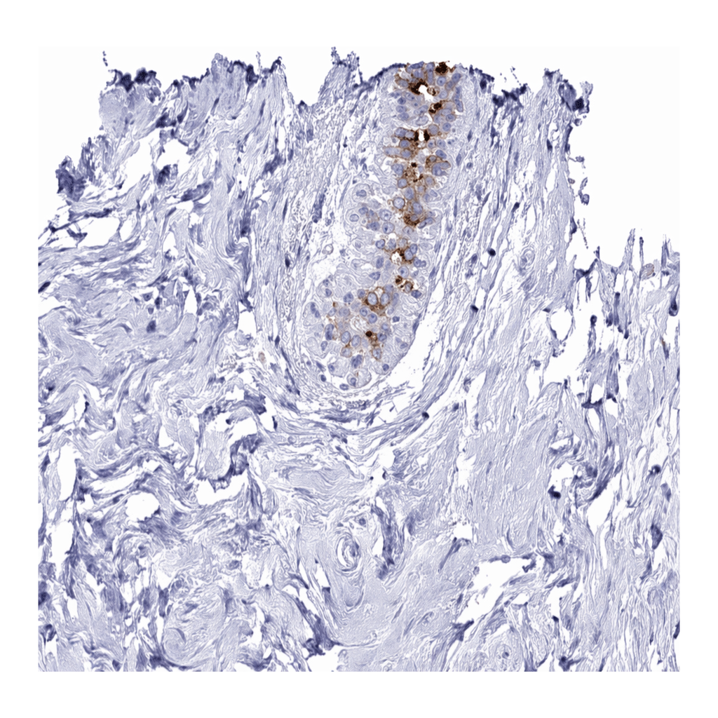 Atlas Antibodies Anti-MGP Antibody