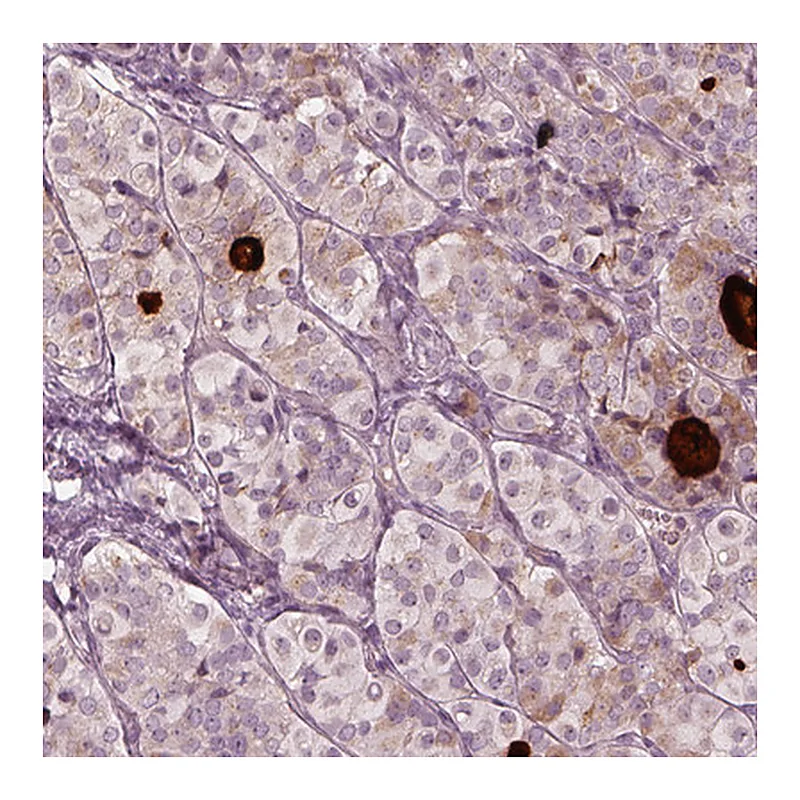 Atlas Antibodies Anti-MIA Antibody