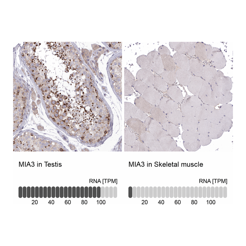 Atlas Antibodies Anti-MIA3 Antibody