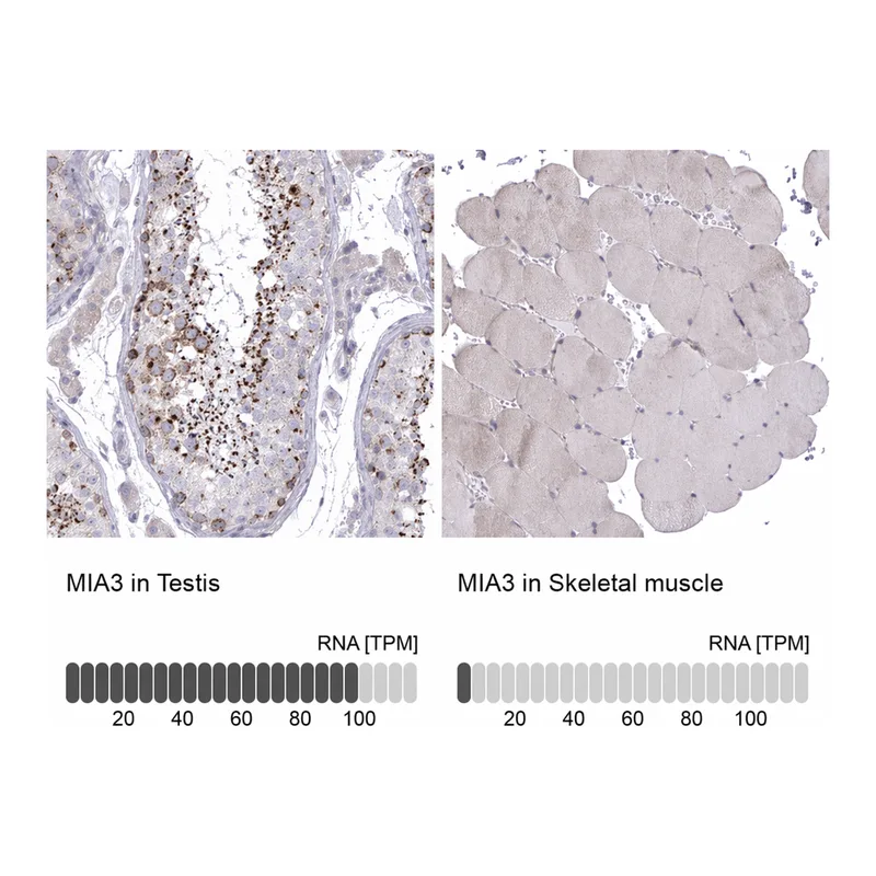 Atlas Antibodies Anti-MIA3 Antibody