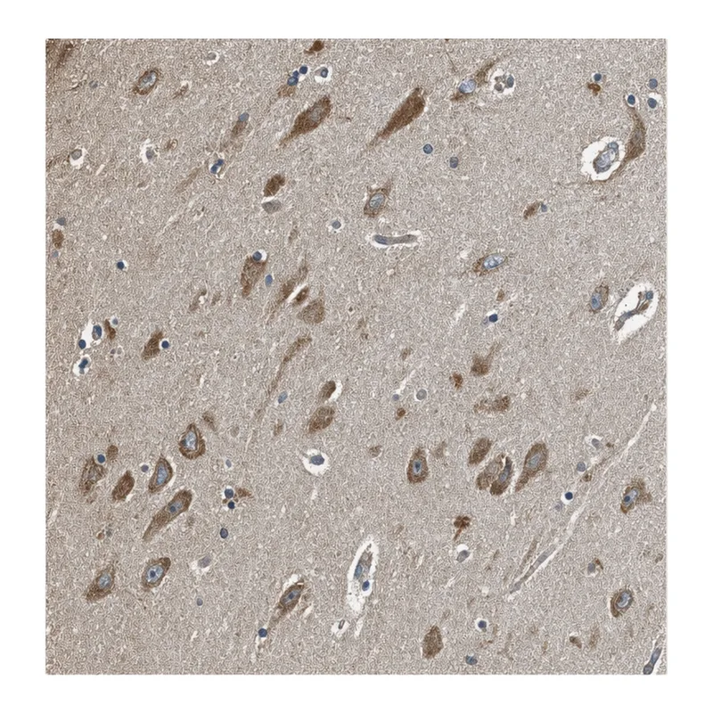 Atlas Antibodies Anti-MIB1 Antibody