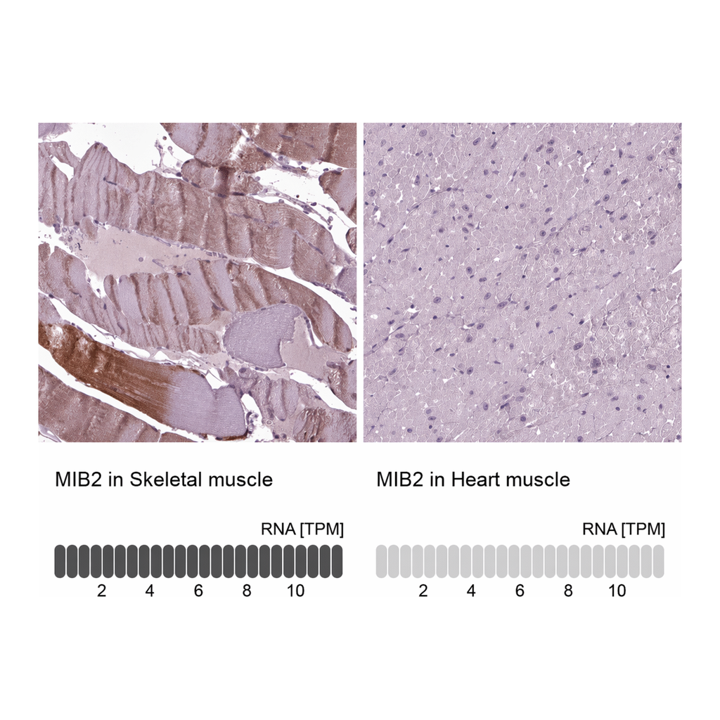 Atlas Antibodies Anti-MIB2 Antibody