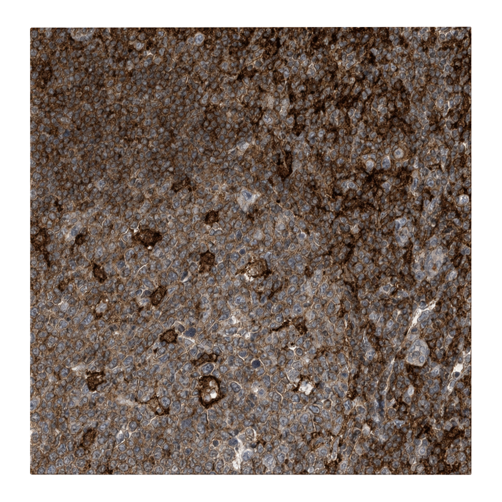 Atlas Antibodies Anti-MICAL1 Antibody