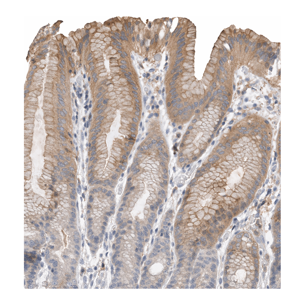 Atlas Antibodies Anti-MICAL1 Antibody