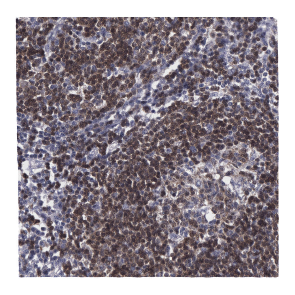 Atlas Antibodies Anti-MICAL3 Antibody