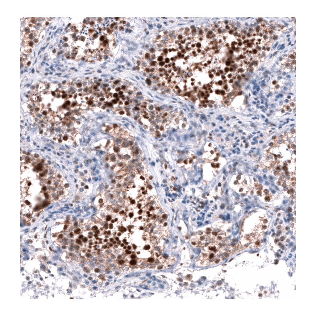 Atlas Antibodies Anti-MICAL2 Antibody