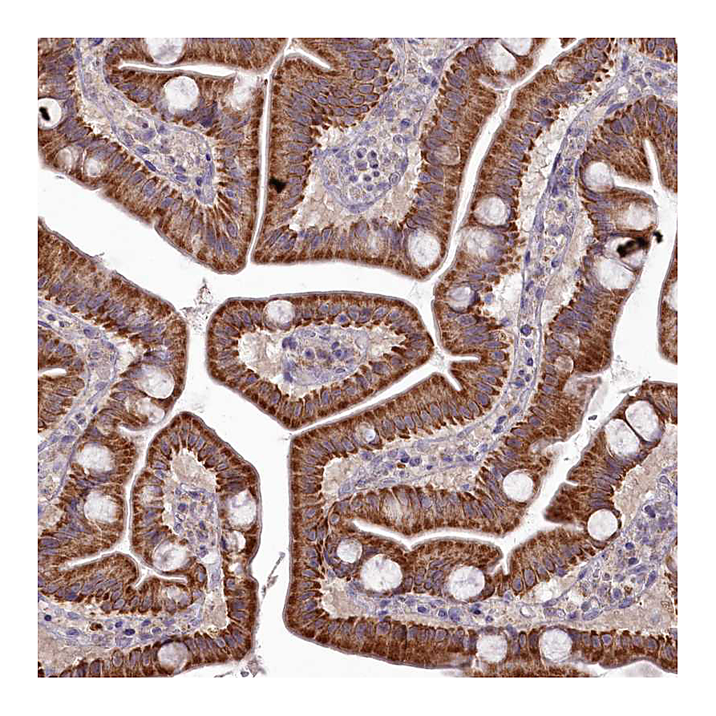 Atlas Antibodies Anti-MICU2 Antibody