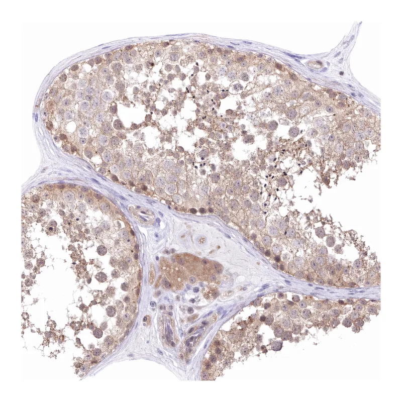 Atlas Antibodies Anti-MIEN1 Antibody
