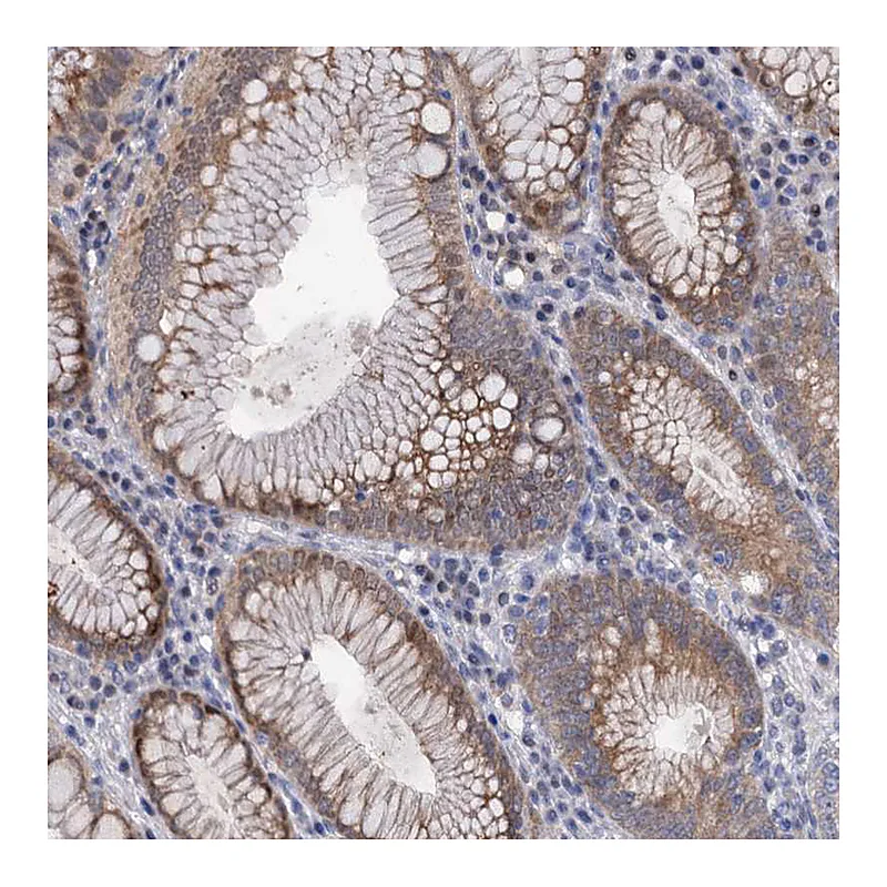 Atlas Antibodies Anti-MID1IP1 Antibody
