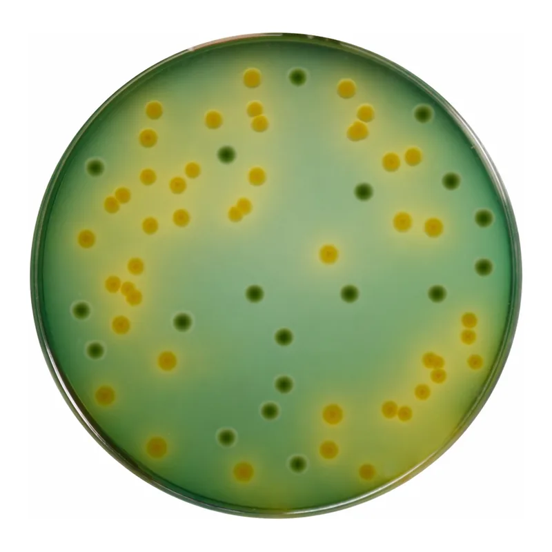 Himedia TCBS Agar