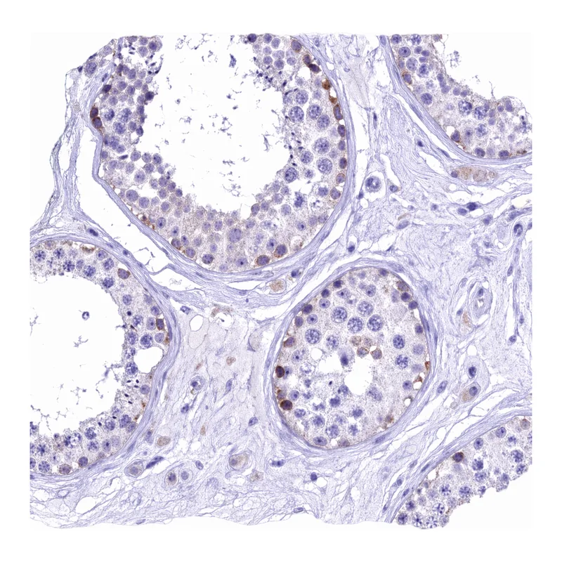 Atlas Antibodies Anti-MIIP Antibody