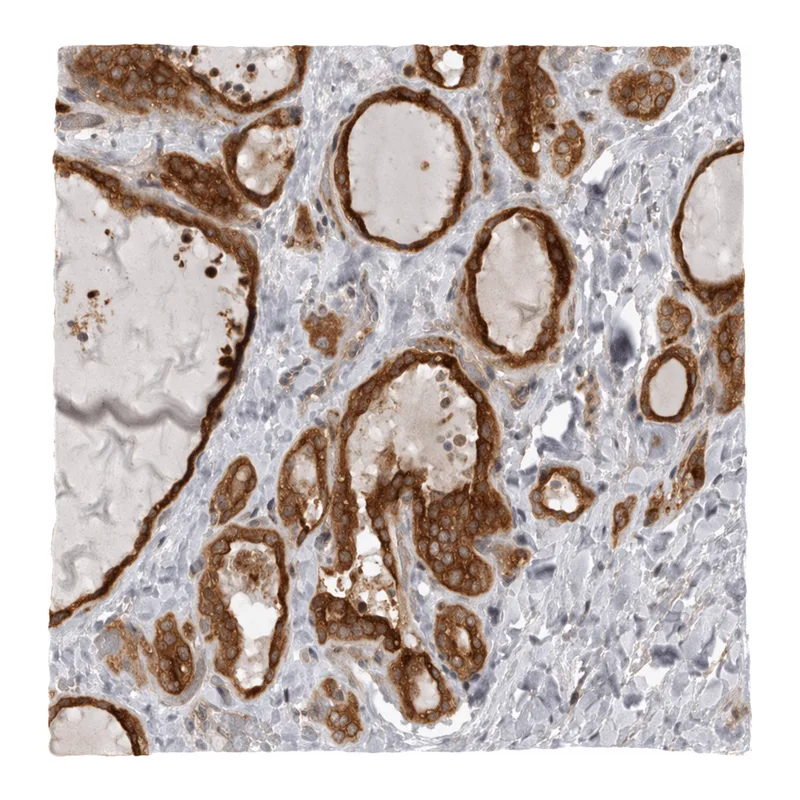 Atlas Antibodies Anti-MINDY1 Antibody