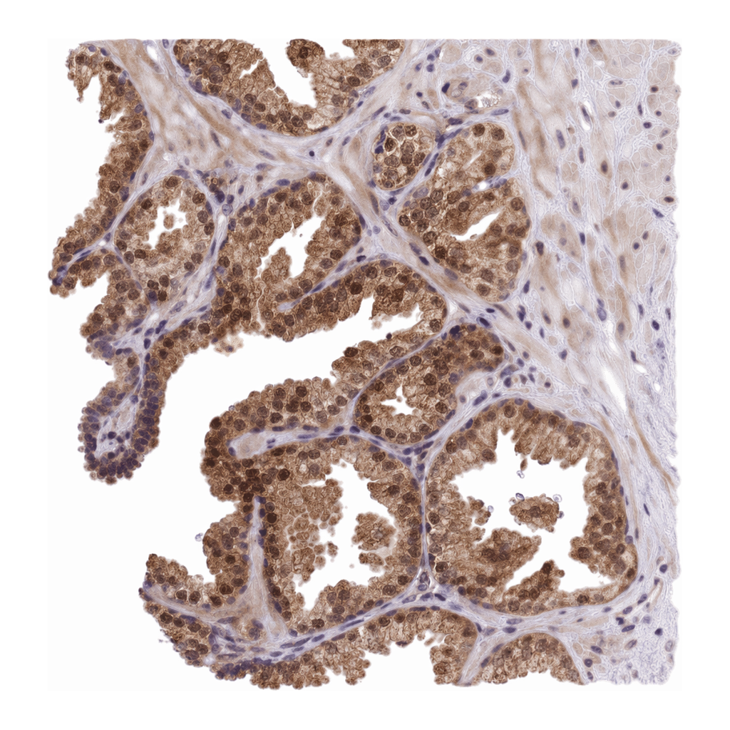 Atlas Antibodies Anti-MINDY2 Antibody