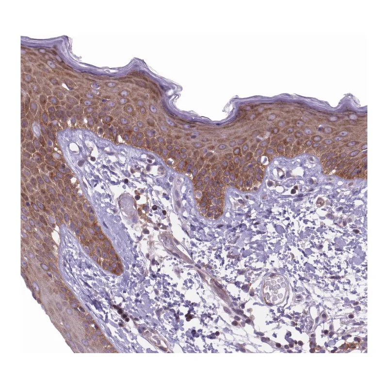 Atlas Antibodies Anti-MINK1 Antibody