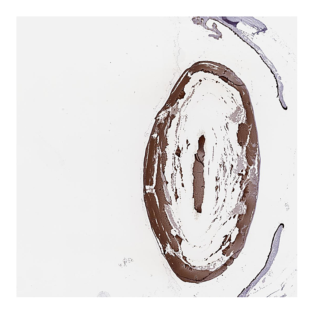 Atlas Antibodies Anti-MIP Antibody