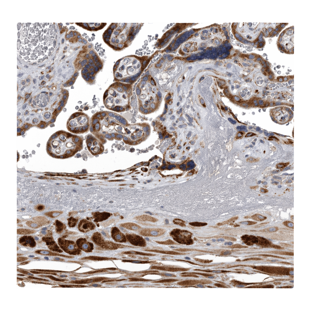 Atlas Antibodies Anti-MINPP1 Antibody