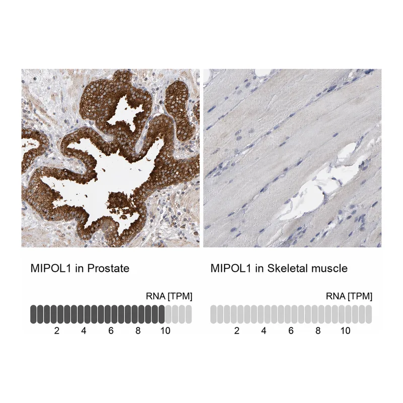 Atlas Antibodies Anti-MIPOL1 Antibody