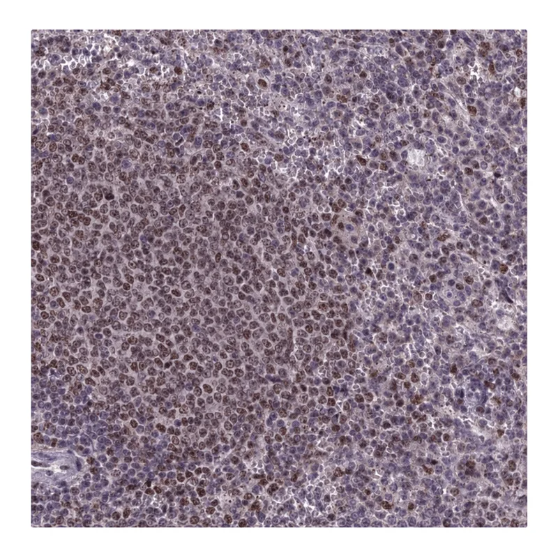 Atlas Antibodies Anti-MIS12 Antibody