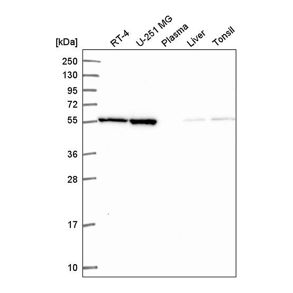 Atlas Antibodies Anti-MIPOL1 Antibody