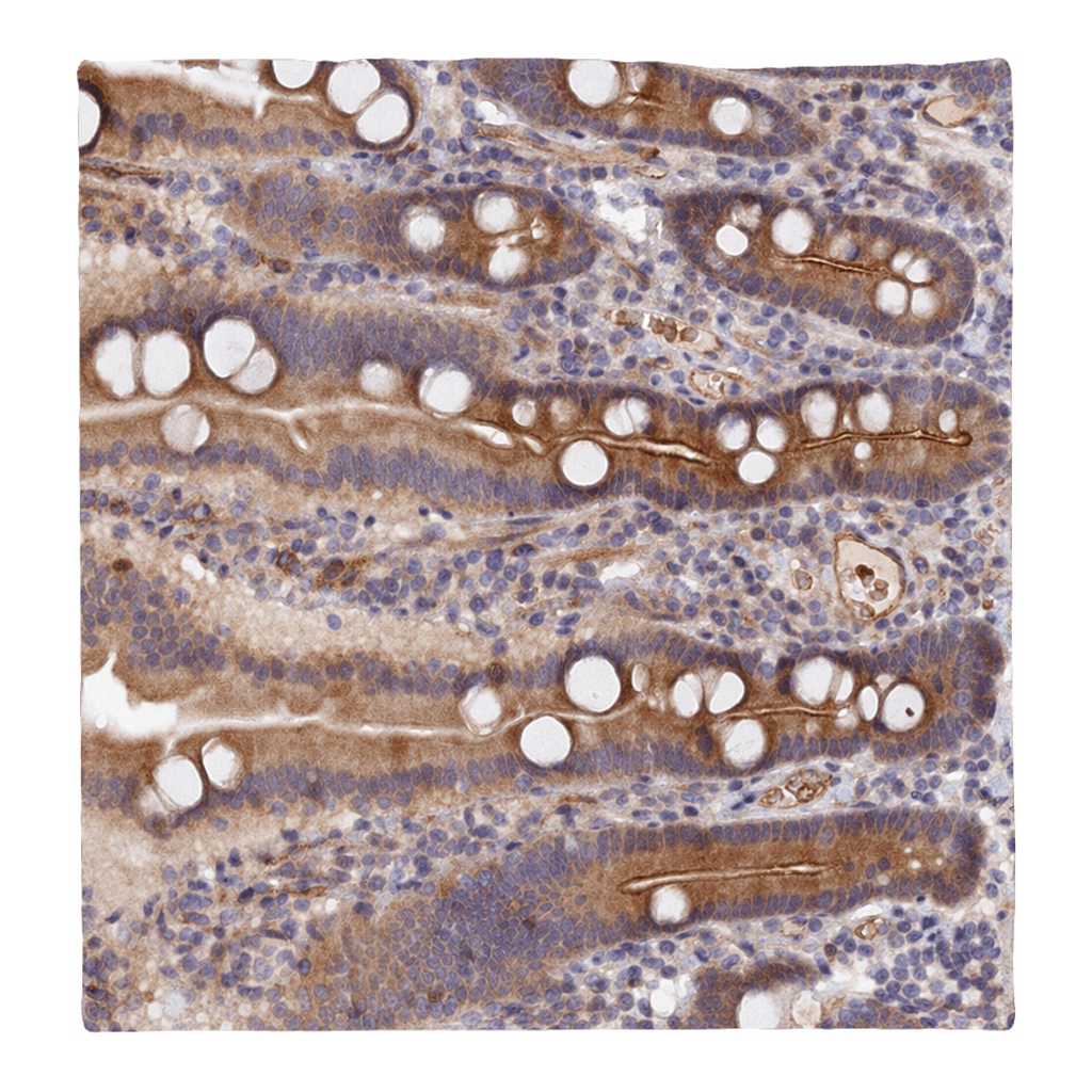 Atlas Antibodies Anti-MISP3 Antibody