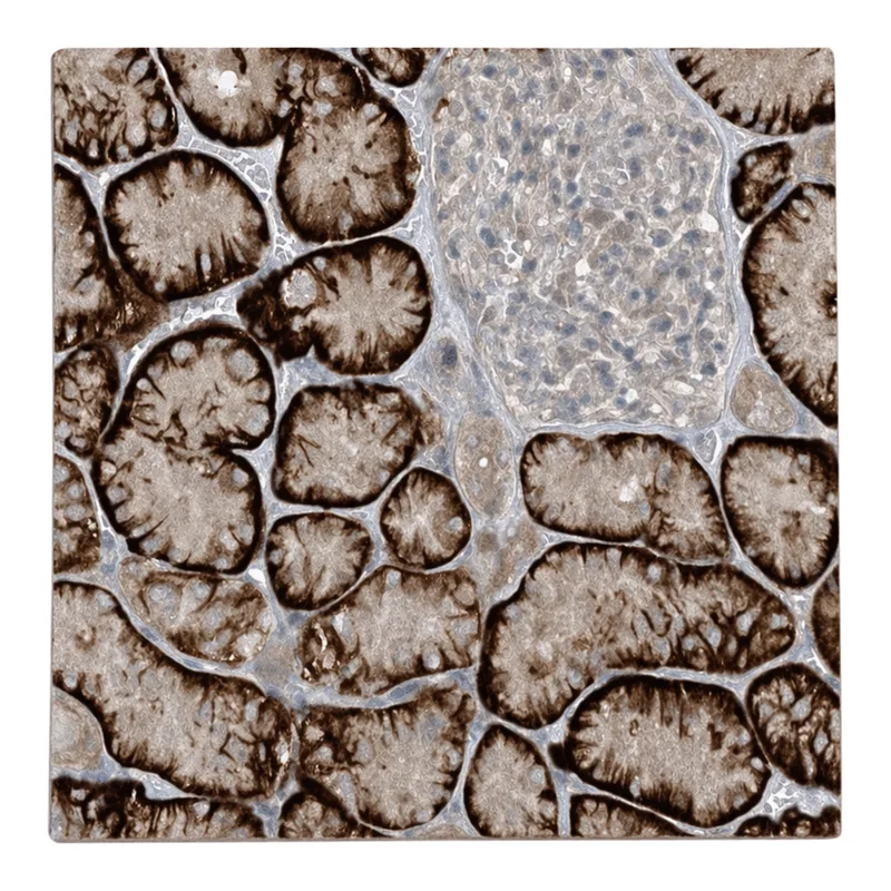 Atlas Antibodies Anti-MITD1 Antibody