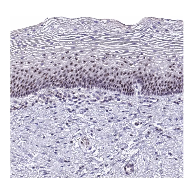 Atlas Antibodies Anti-MKI67IP Antibody