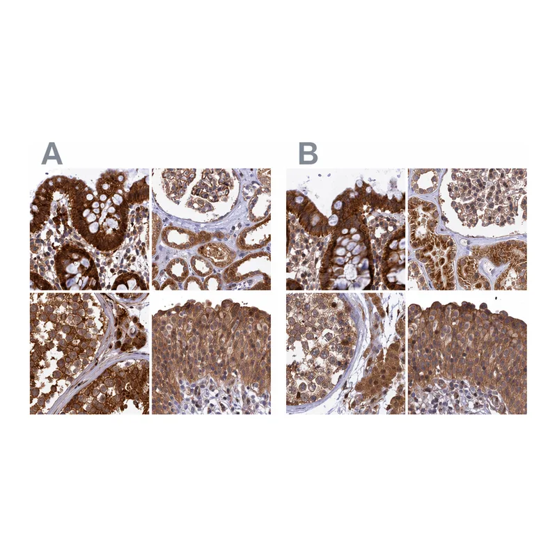 Atlas Antibodies Anti-MKKS Antibody