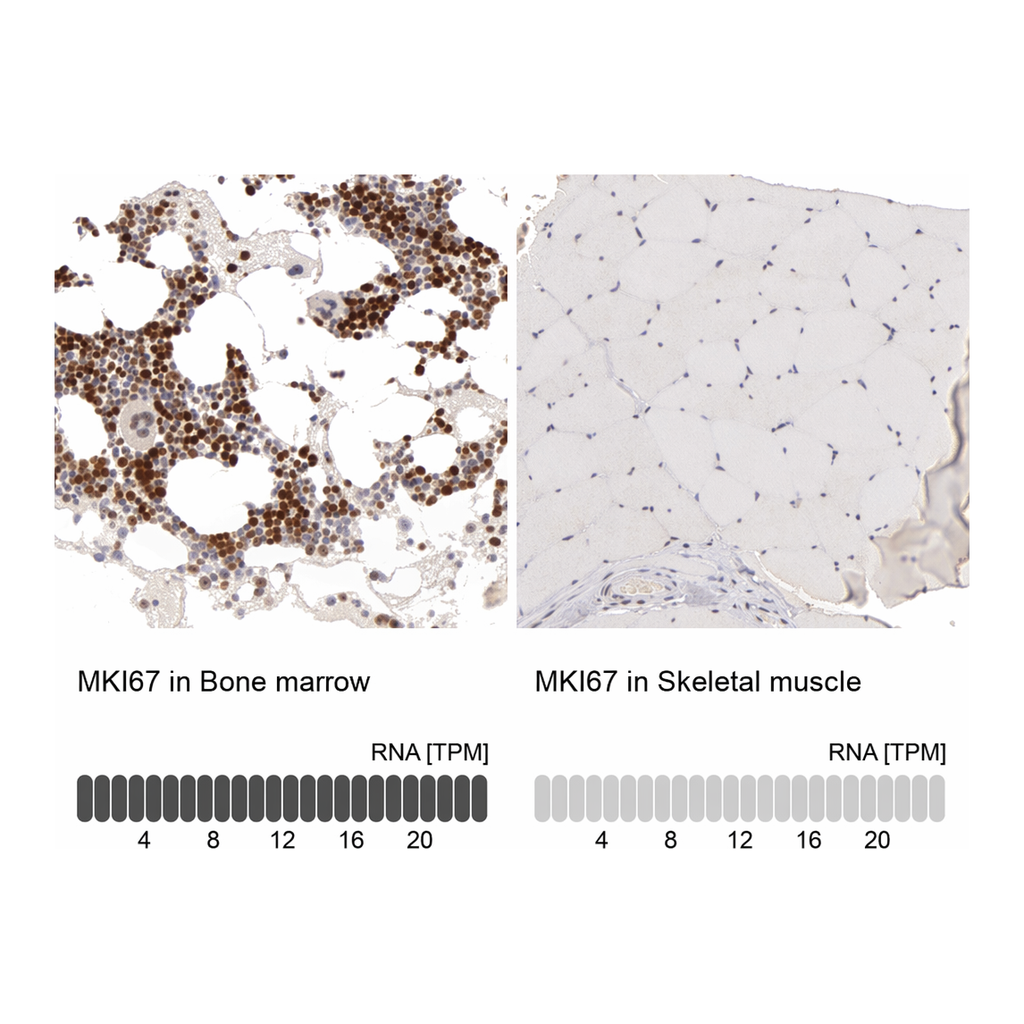 Atlas Antibodies Anti-MKI67 Antibody