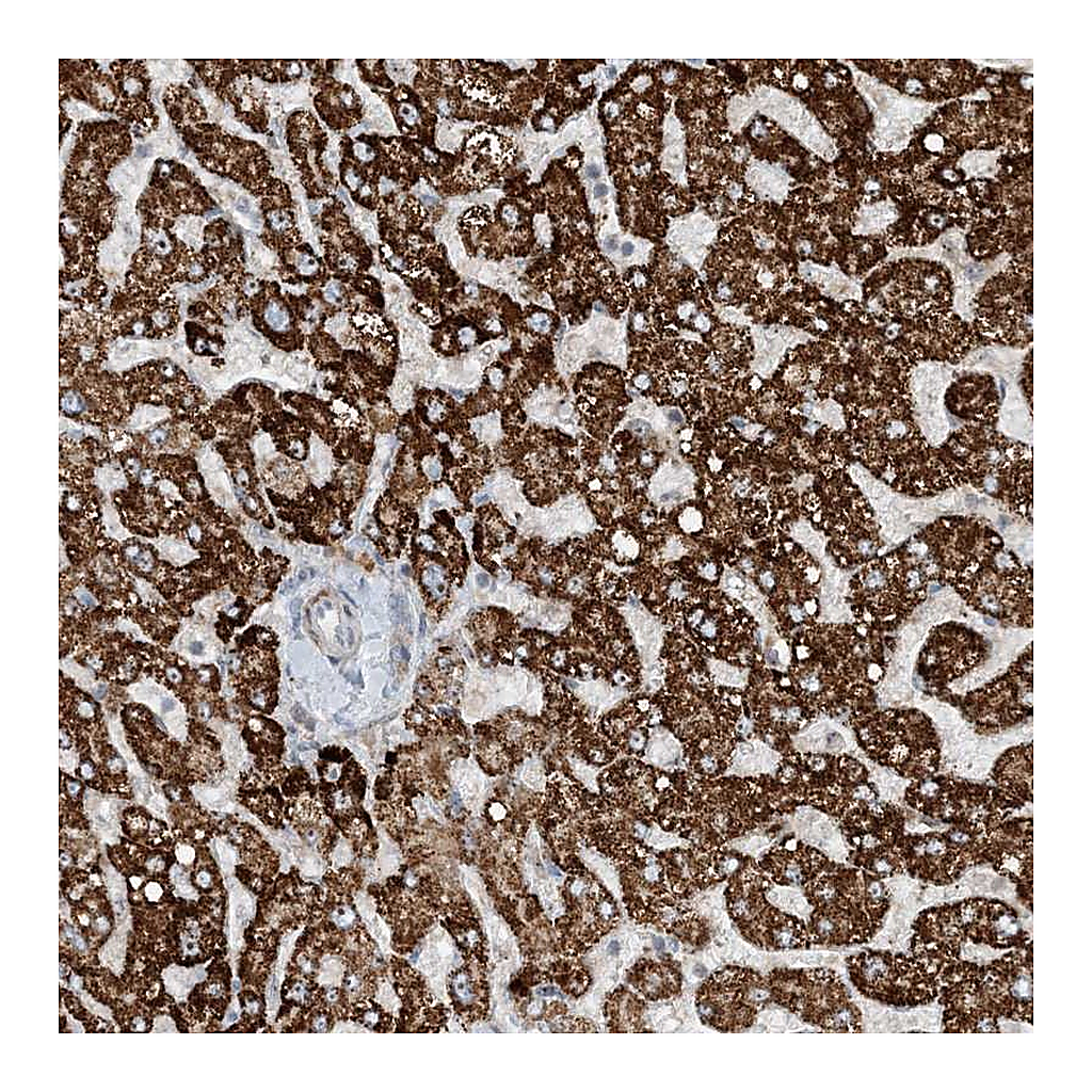 Atlas Antibodies Anti-MITD1 Antibody