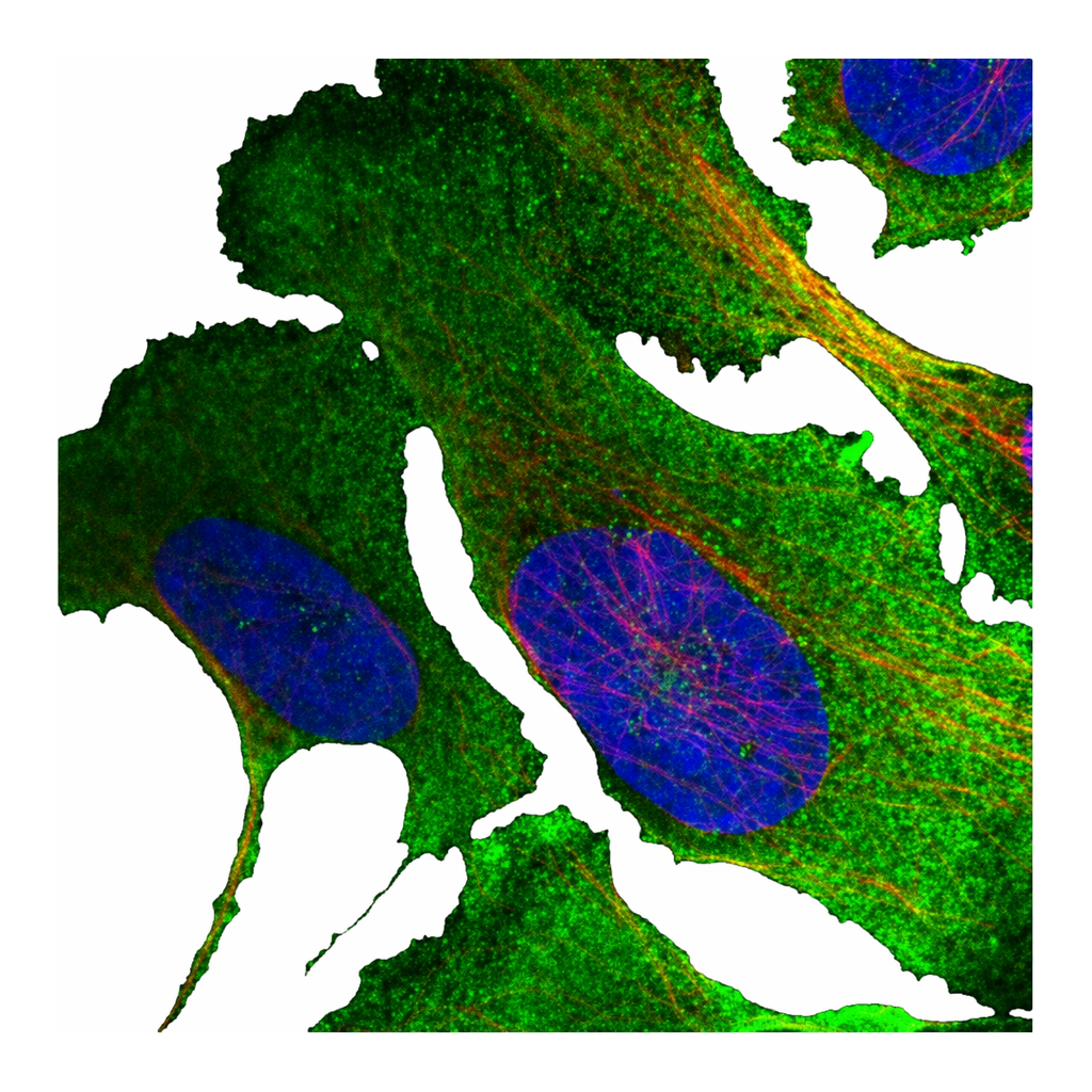 Atlas Antibodies Anti-MKLN1 Antibody
