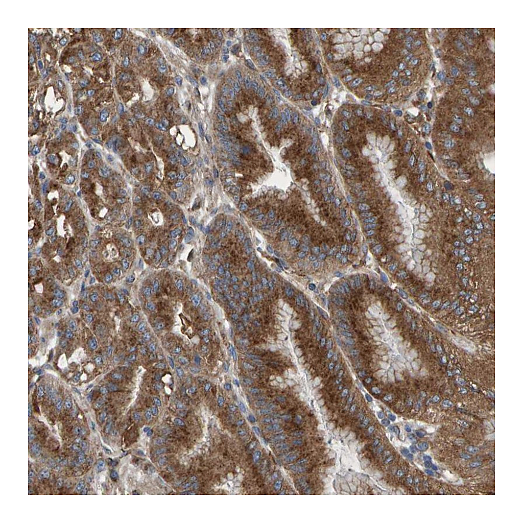 Atlas Antibodies Anti-MKLN1 Antibody