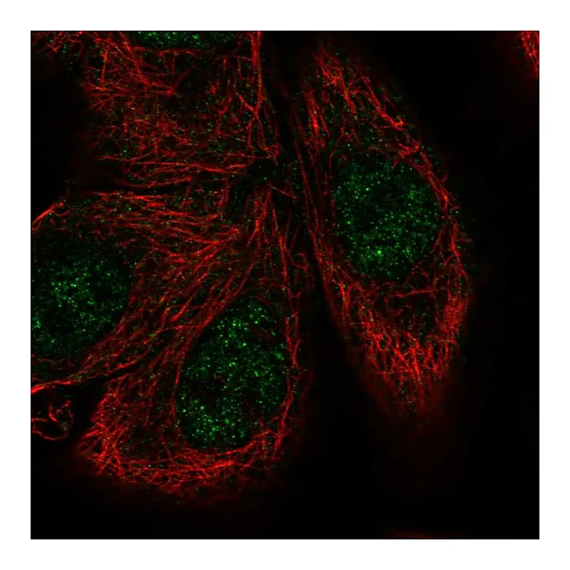 Atlas Antibodies Anti-MKNK1 Antibody