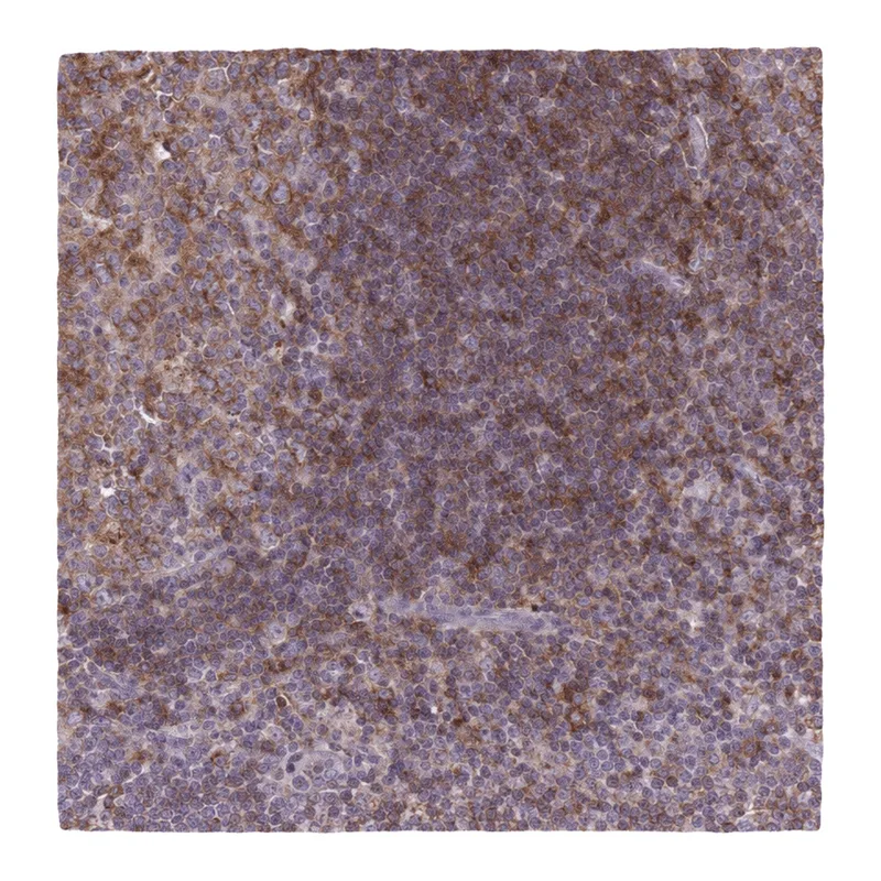 Atlas Antibodies Anti-MKRN2OS Antibody