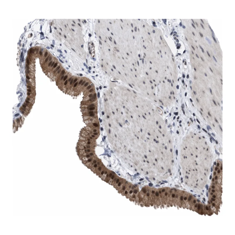 Atlas Antibodies Anti-MKNK2 Antibody