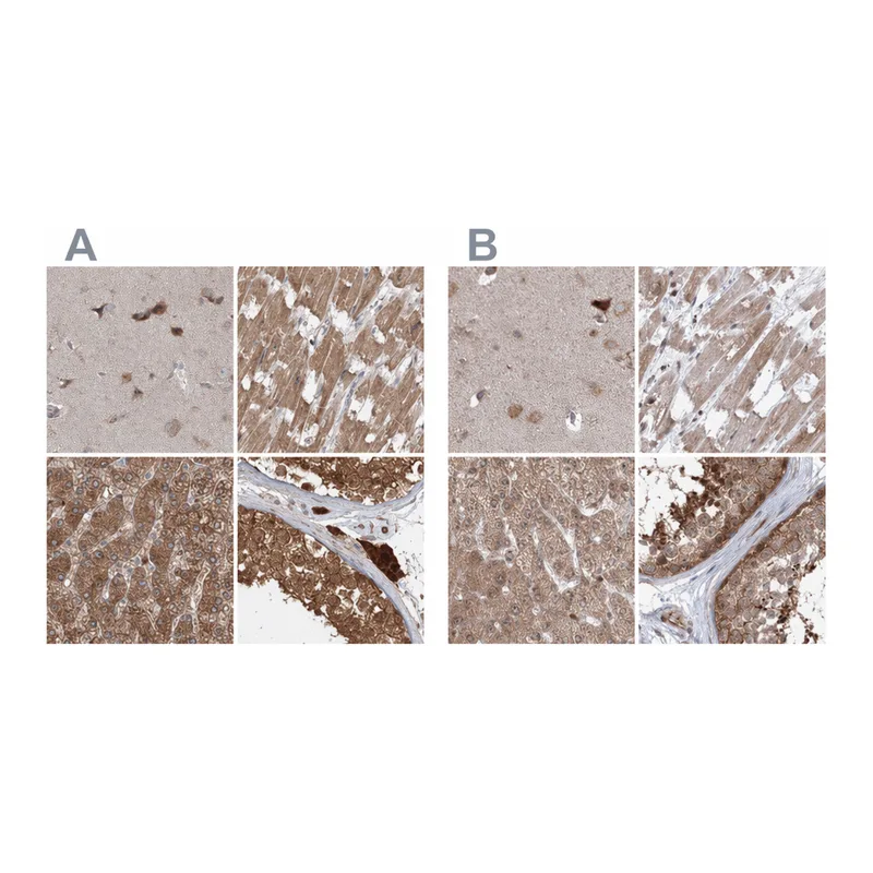 Atlas Antibodies Anti-MKRN2 Antibody