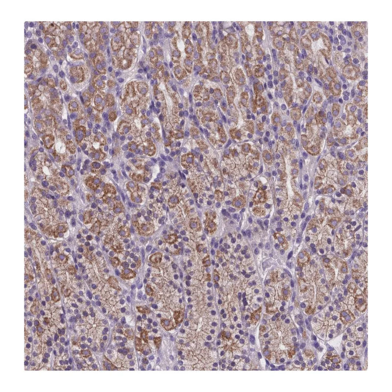 Atlas Antibodies Anti-MKRN2OS Antibody