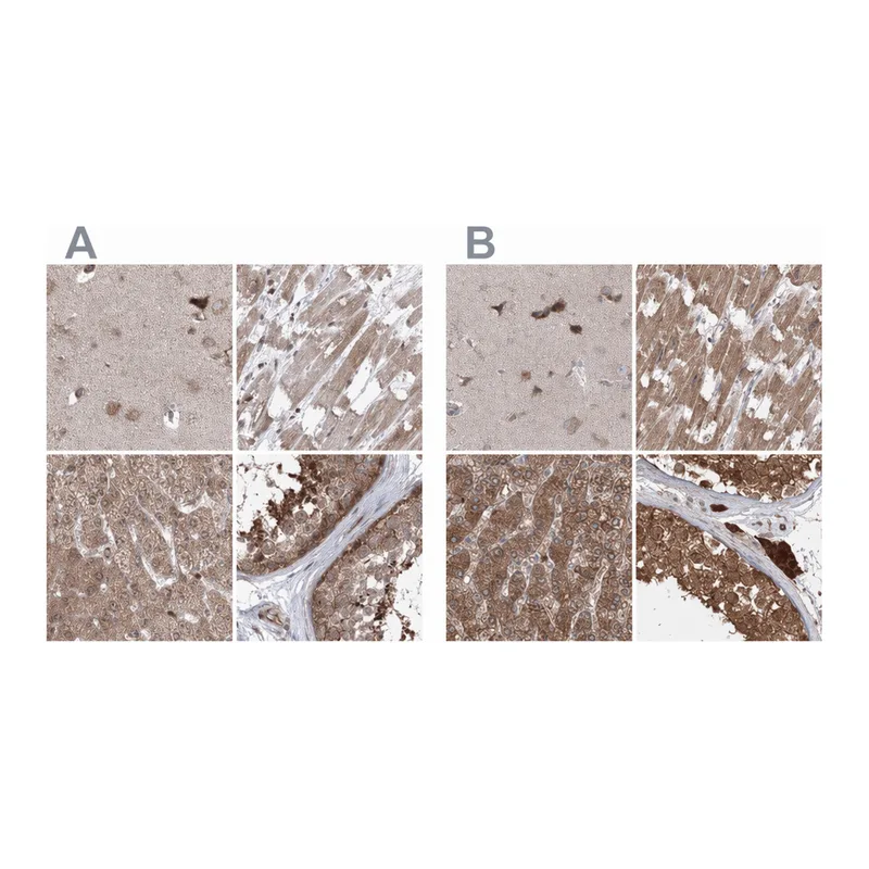 Atlas Antibodies Anti-MKRN2 Antibody