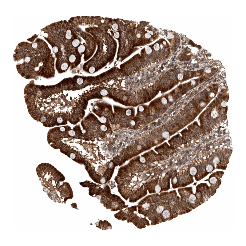 Atlas Antibodies Anti-MKRN3 Antibody