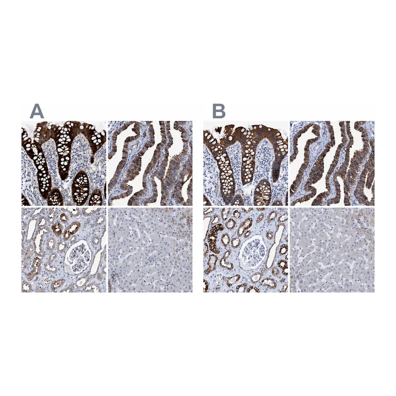 Atlas Antibodies Anti-MKS1 Antibody