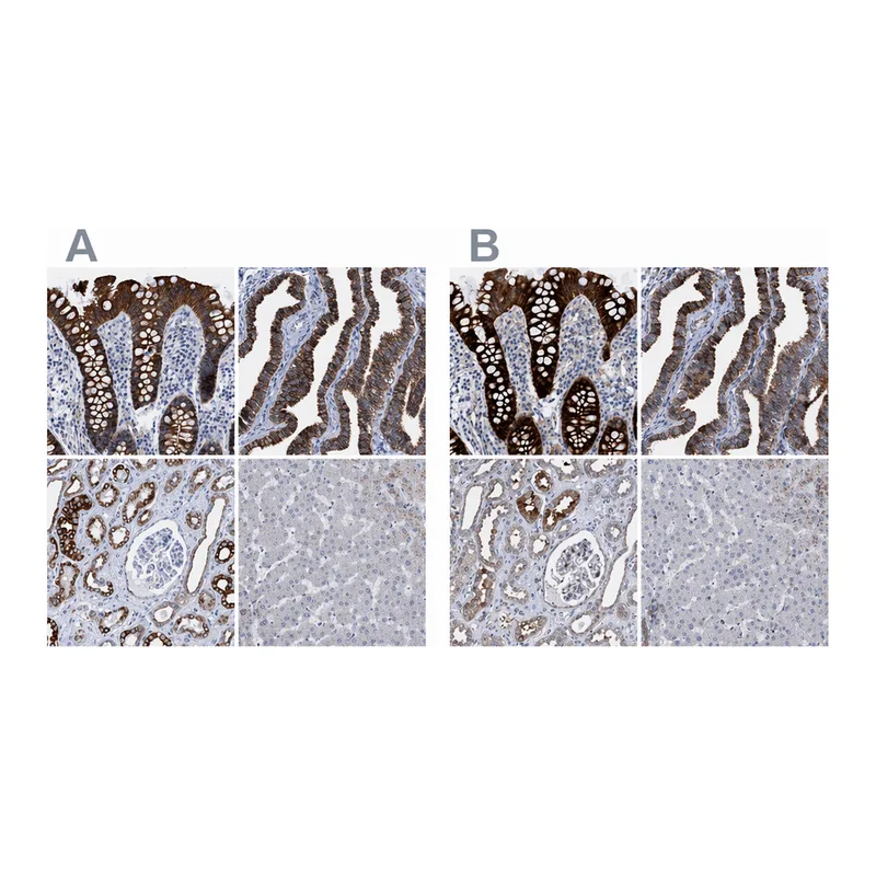 Atlas Antibodies Anti-MKS1 Antibody