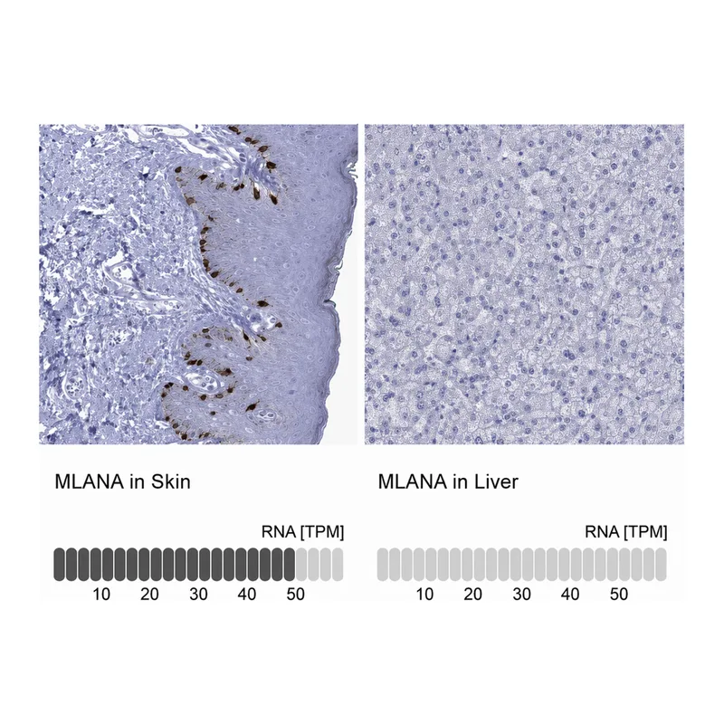 Atlas Antibodies Anti-MLANA Antibody