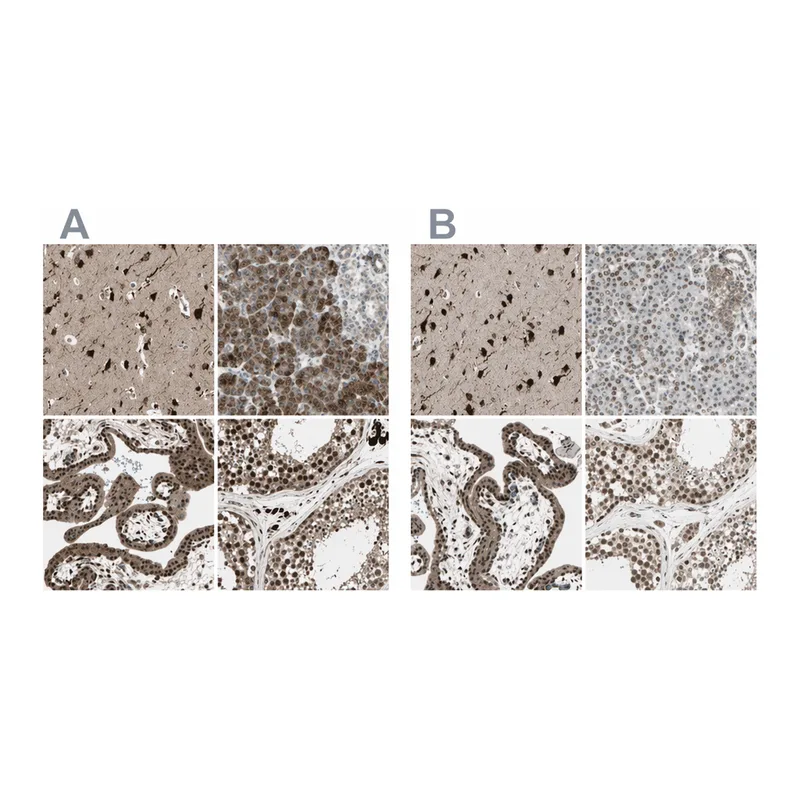Atlas Antibodies Anti-MLF2 Antibody